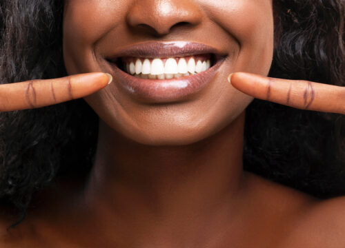 Photo of a woman showing off her white teeth