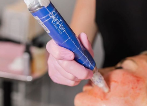 Microneedling