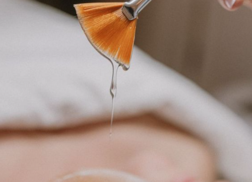 Chemical Peels