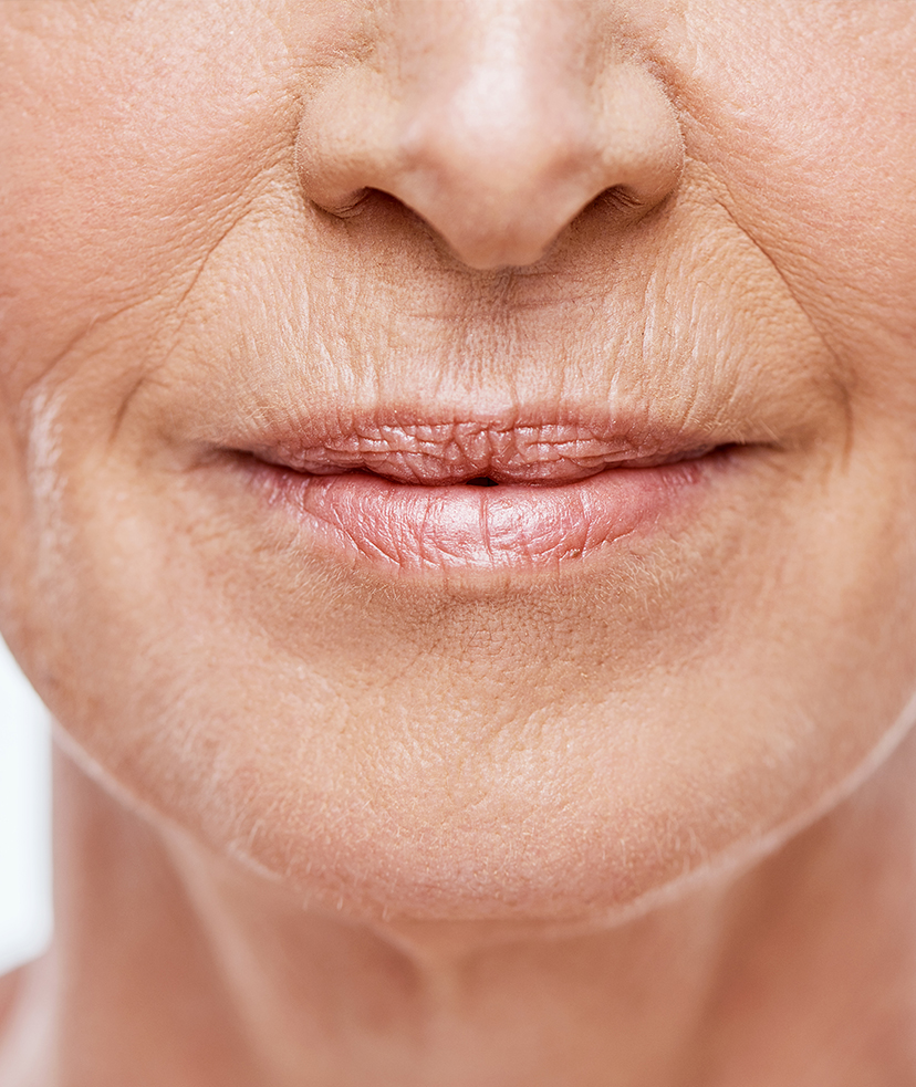 Photo of wrinkles and fine lines around an older woman's mouth